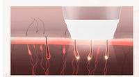 Laser Hair Removal Equipment Photon Skin Rejuvenation Hair Removal Equipment